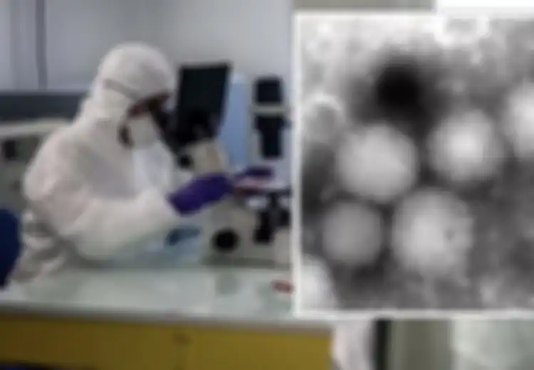 Virus Baru Ditemukan di Negara Asia Ini, Namanya Virus Yezo, Sudah Menginfeksi Manusia, dan Bisa Menyebabkan Kondisi Ini Jika Menginfeksi Manusia