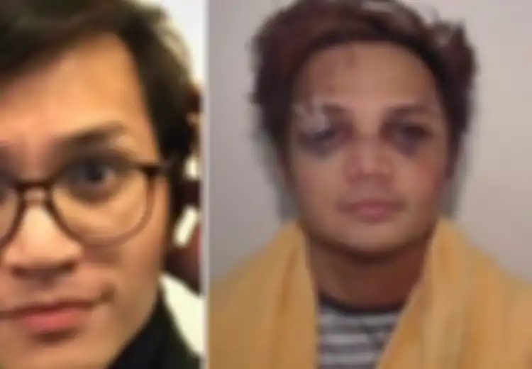 Polisi Inggris Rilis Foto Reynhard Sinaga Babak Belur, Dokter Boyke Bongkar Analisis Perilaku Pelaku Pemerkosaan Terbesar Inggris Itu, Hasilnya Tak Terduga