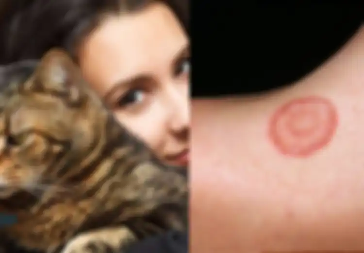 Pecinta Kucing dan Anjing Wajib Tahu, Ringworm Luka Melingkar di Tubuh Anda Bisa Jadi Ketularan dari Binatang Peliharaan Anda, Apa itu Ringworm?