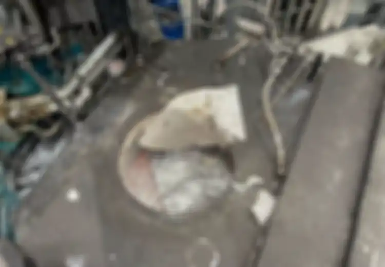Ngeri! Tercebur dan Alami Luka Bakar, Pria Ini Selamatkan Diri dari Tungku Aluminium Panas