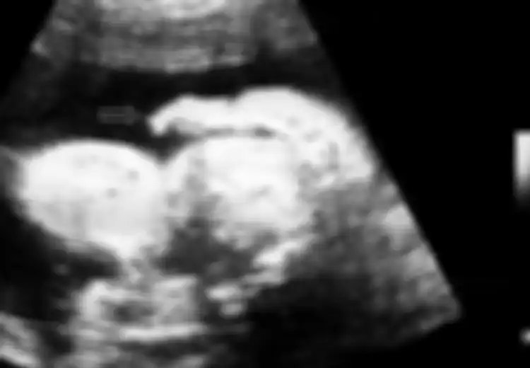 Bayi Itu Keluarkan Bayi dari Mulut