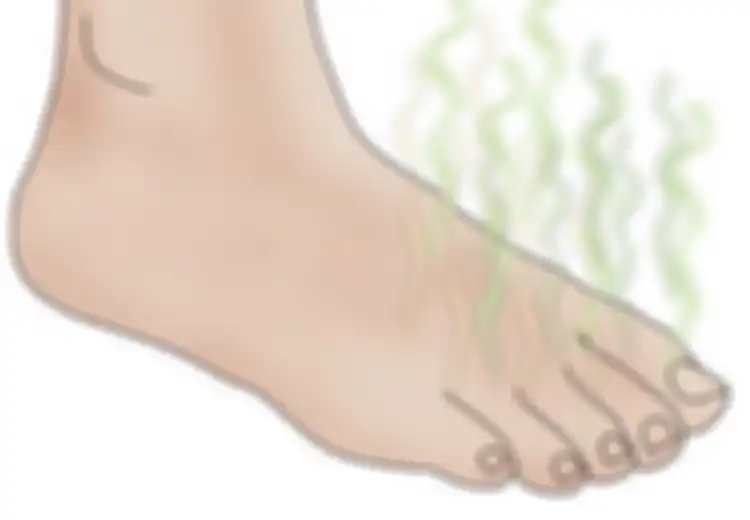 5 Langkah Usir Bau Kaki