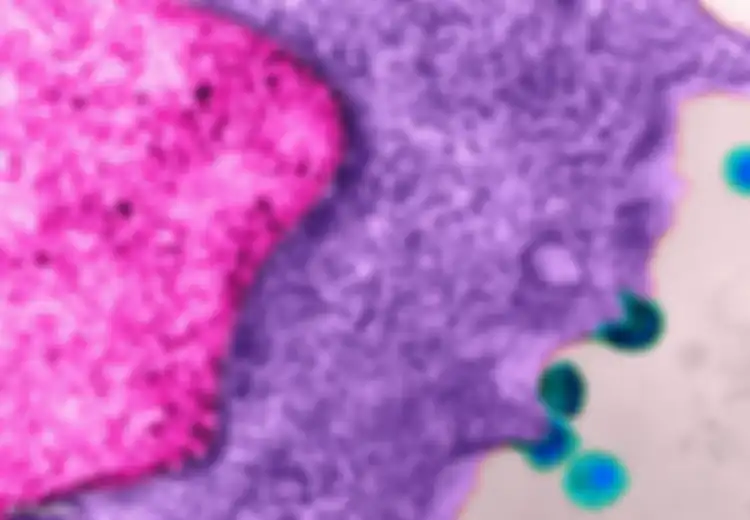 Ditemukan, Tipe Terbaru HIV yang Lebih Menular