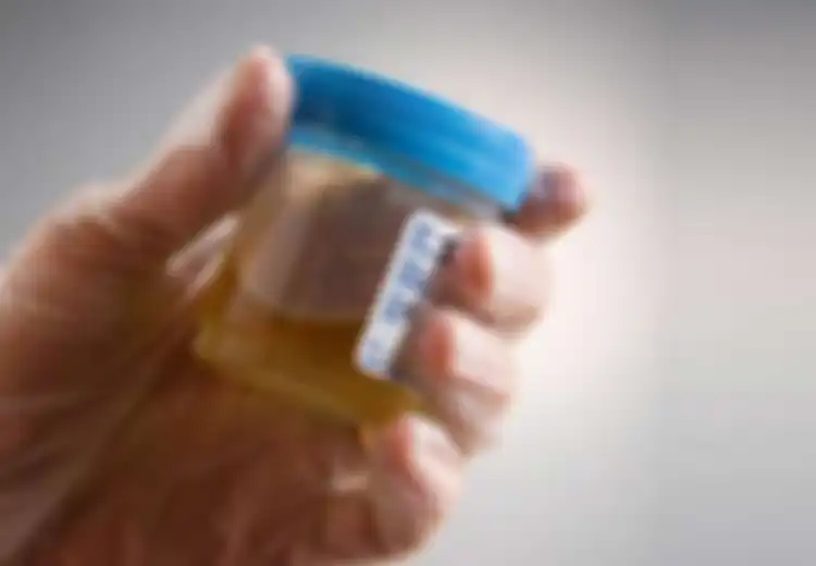 Ada Lebih dari 10 Warna Urine dan Semuanya Menjelaskan Kesehatan Anda, Catat Baik-baik!