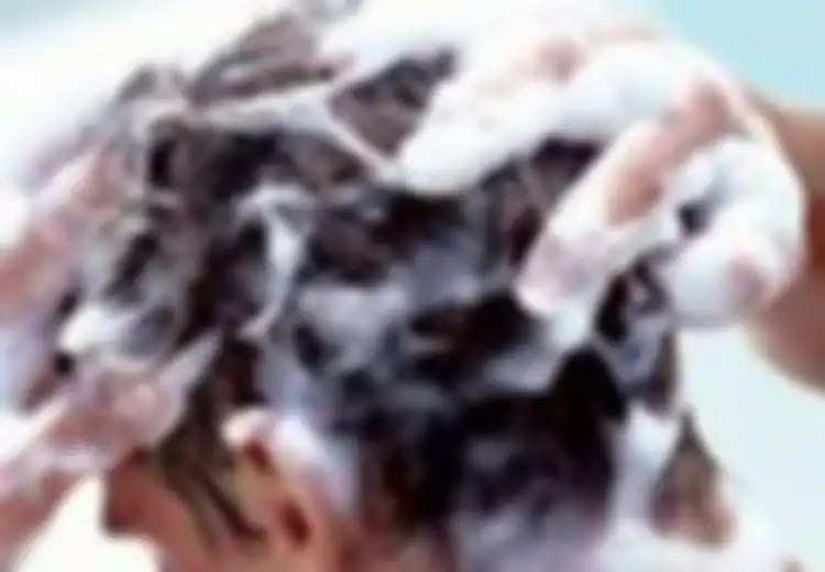 Rambut Rontok Gara-gara Tidak Kebagian Makanan