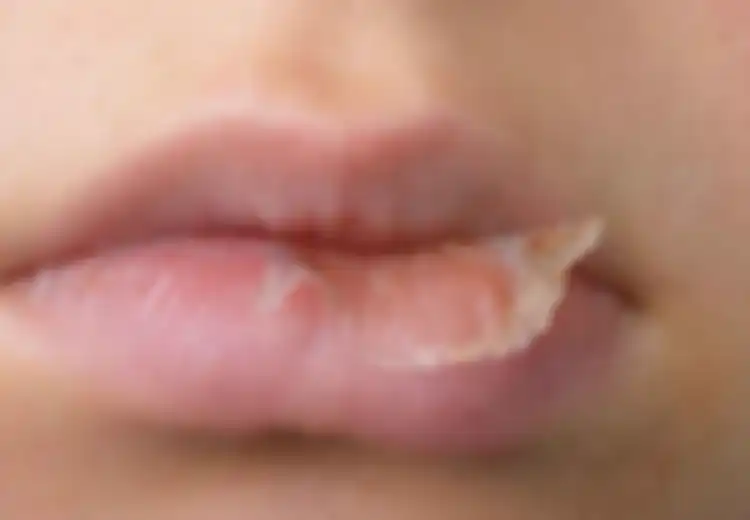 Terungkap, Bahan-bahan dalam Lip Balm Ini Bikin Bibir Kering 