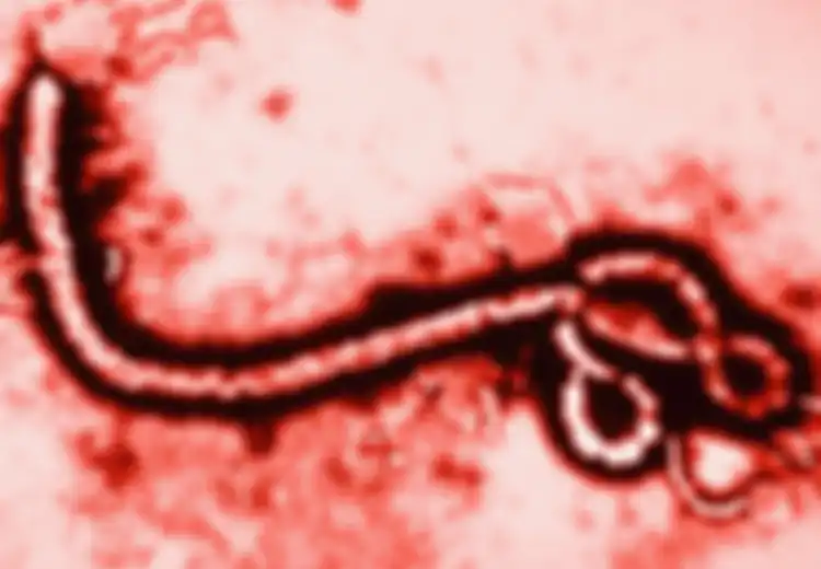 HIV Belum Ada Apa-apanya, Ini 10 Virus Paling Mematikan di Dunia