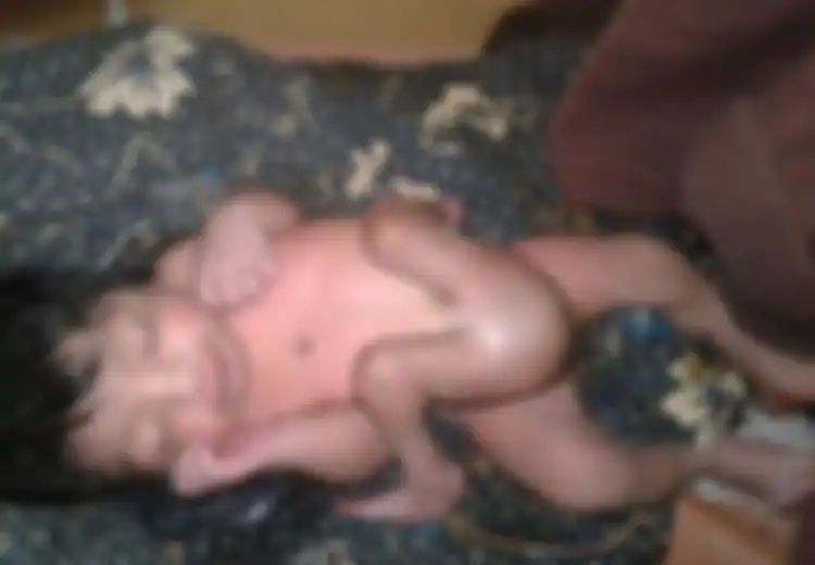 Di India, Ada Bayi Lahir dengan Empat Kaki dan Dua Penis