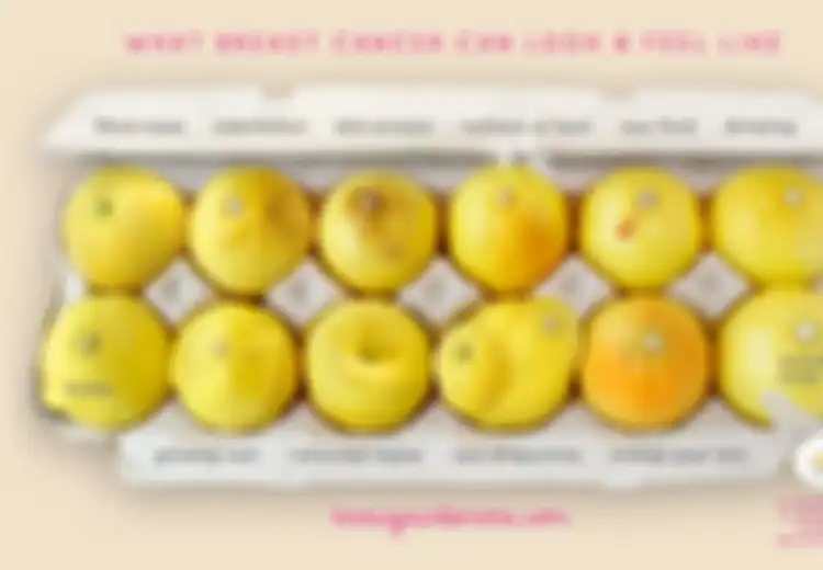 Yana Zein Meninggal Dunia: Lewat Foto Lemon-lemon Ini Wanita Bisa dengan Mudah Deteksi Kanker Payudara