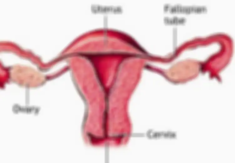 Wahai Wanita, Jangan Khawatir Meski Hidup Tanpa Rahim karena Kanker Serviks