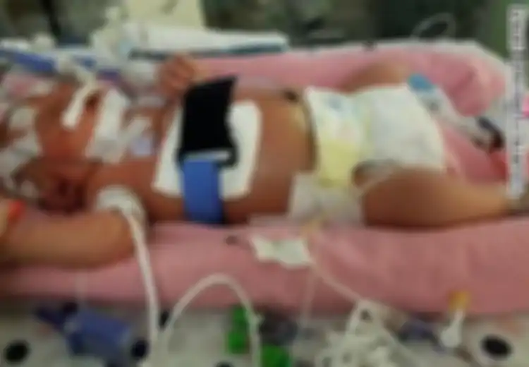 Sedih, Bayi Berusia 18 Hari Ini Meninggal Karena Dicium Oleh Orang yang Terkena Virus Meningitis