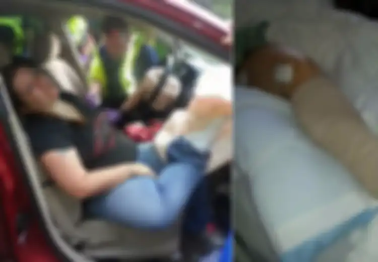 Masih Suka Meletakan Kaki di Dasbor Mobil? Pengalaman Wanita Ini akan Bikin Anda Berubah Pikiran