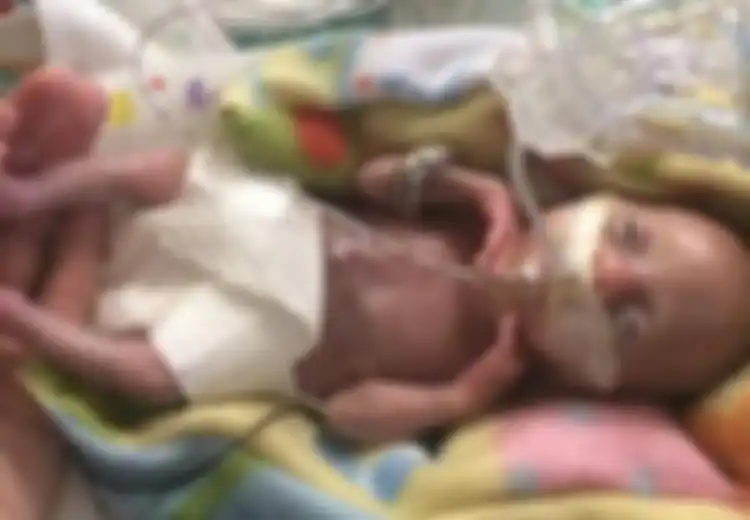 Diberi Label ‘Bayi Paling Prematur yang Pernah Ada’, Bayi ‘Ajaib’ Ini Berhasil Tumbuh Sehat