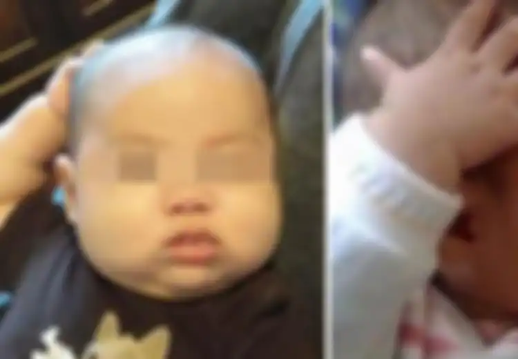 Orangtua, Jangan Pernah Abaikan Gerakan Berulang yang Dilakukan Bayi! Kasus Ini Contohnya