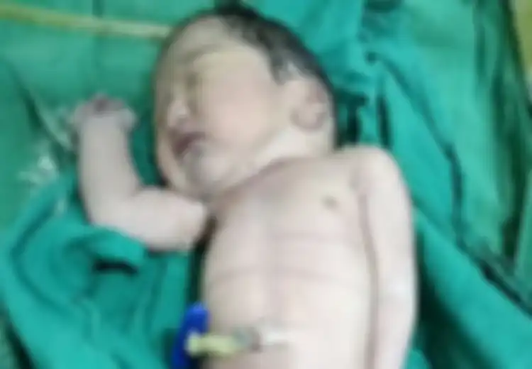 Kasihan, Bayi Ini Terlahir Benar-Benar Seperti ‘Putri Duyung’, Jenis Kelaminnya Pun Belum Diketahui