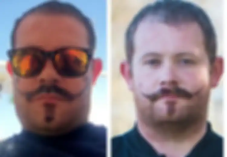 Pria Ini Mendadak Punya Luka Berbentuk Kumis Gara-gara Ditato dengan Henna