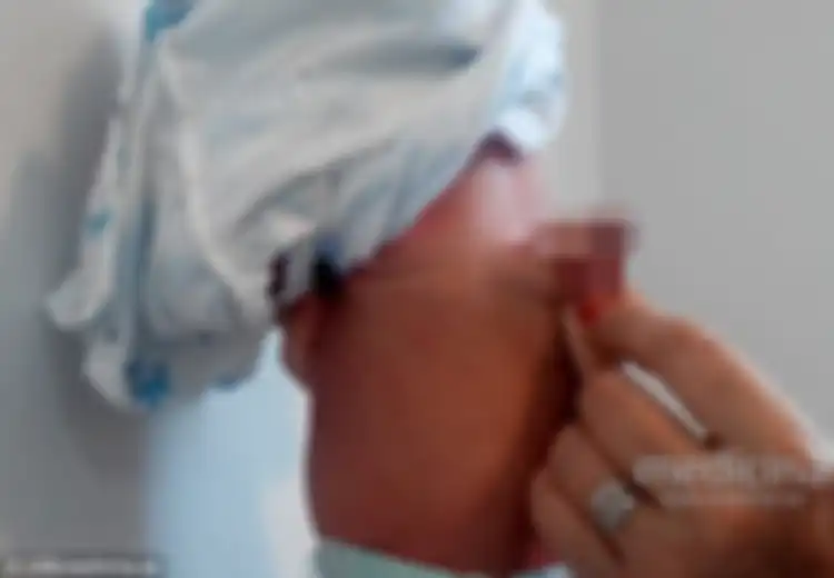 Bayi Ini Lahir dengan 2 Alat Kelamin: Yang Satu Tumbuh di Tempat Biasa, Satu Lagi Tumbuh di Punggung