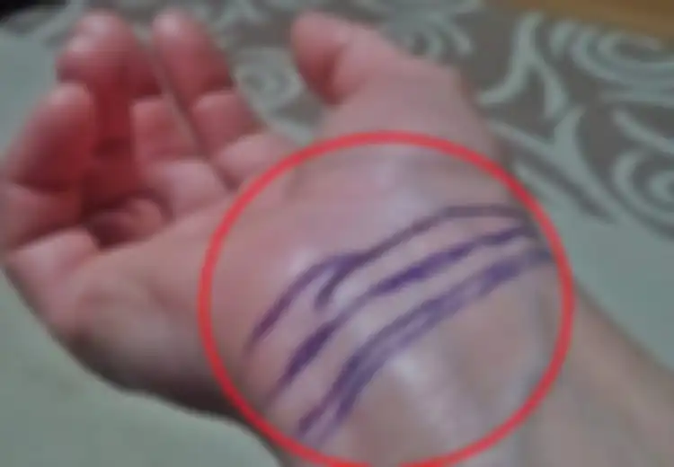 Garis pada Pergelangan Tangan Anda Ternyata Memiliki Arti Lo, Yuk Cari Tahu!
