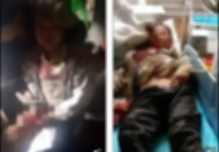 Berhentilah Memakai Handphone Saat Dicharge, Anak Ini Matanya Buta Karena Ponselnya Meledak