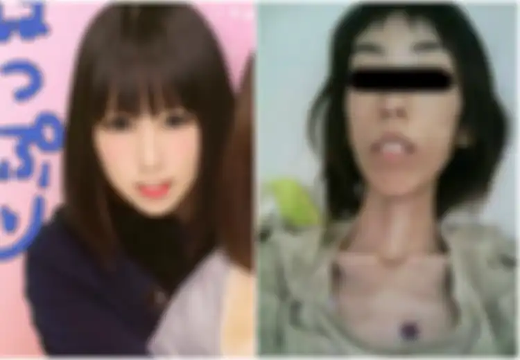 Selalu Disiksa Sang Kakek, Berat Badan Wanita Cantik Ini Sampai Tinggal 16,8 Kilogram