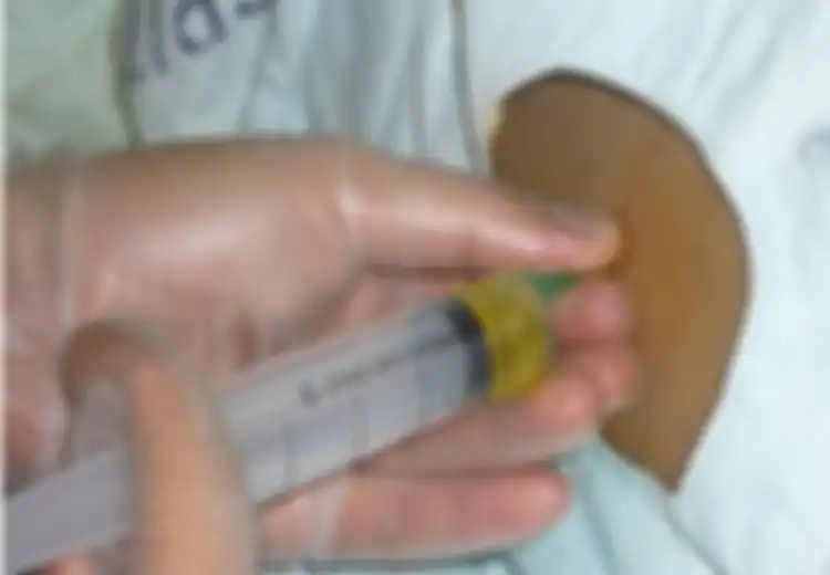 Menyamar Jadi Dokter, Sindikat Perampok ini Perdaya Wanita, Kemudian Curi Cairan Otaknya untuk Dijual di Pasar Gelap