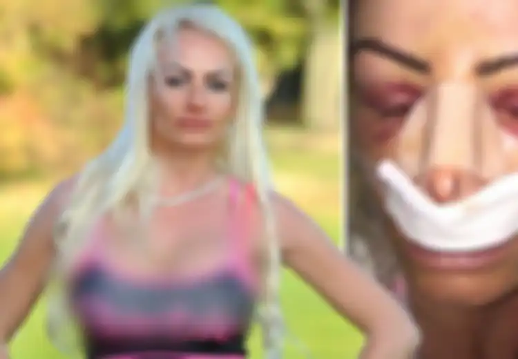 Sempat Tak Disukai Suami, Perempuan Ini Habiskan Uang Rp2,4 Miliar untuk Operasi Agar Menjadi Barbie Hidup dari Inggris