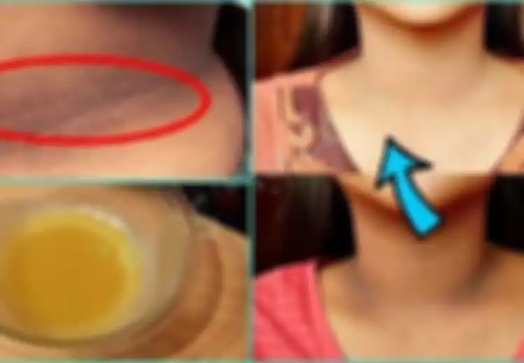 Alami Masalah Kulit Gelap? Jangan Khawatir, Tuntaskan Dengan Bahan Rumahan di Bawah Ini