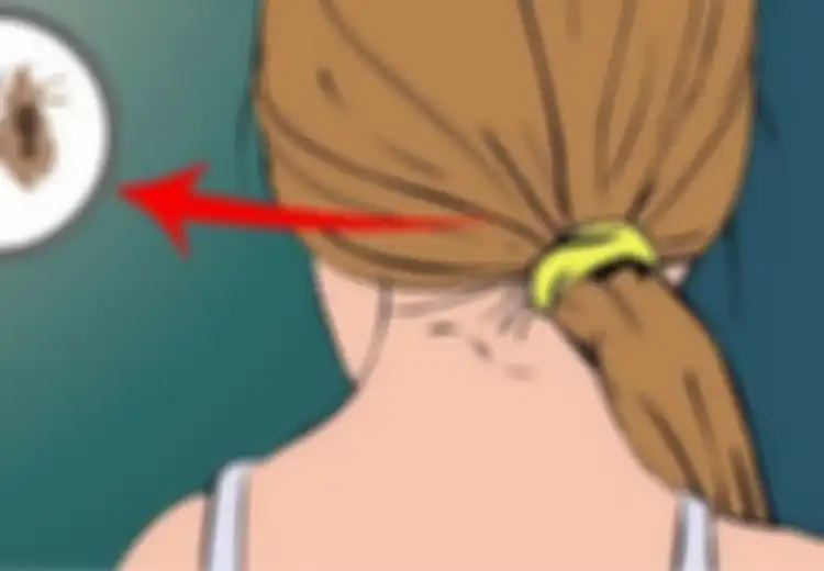 Jengkel dengan Kutu Rambut? Musnahkan dengan Bahan-bahan Alami Berikut