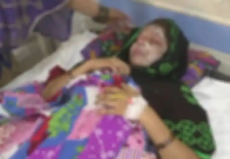 Wajah Ibu Ini Disiram Air Keras oleh Suami Sendiri Gara-gara Melahirkan Seorang Bayi Perempuan