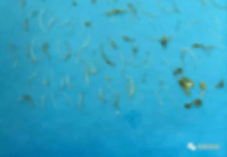 Ada-ada Saja, Pria Ini Jalani Operasi Selama 2 Jam Demi Keluarkan 100 Tulang Ikan Dari Anusnya