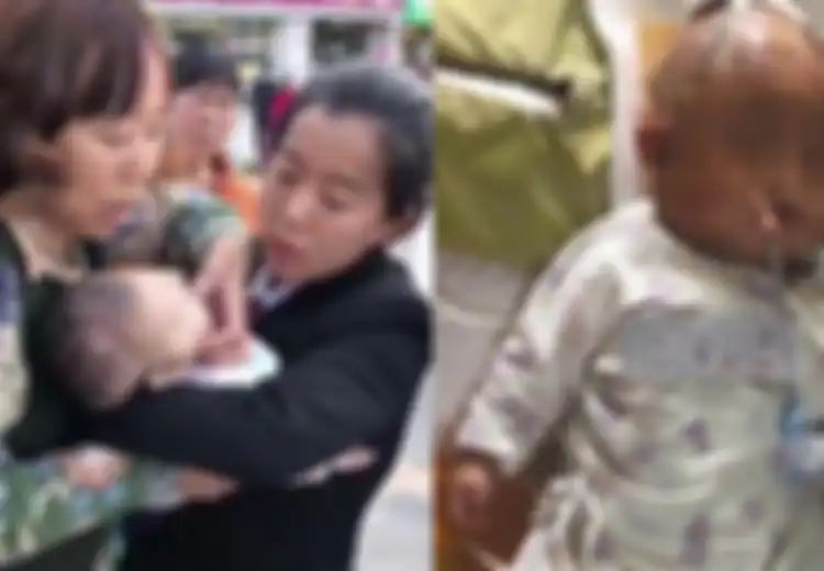 Mengerikan, Bayi Perempuan Ini Mengalami Koma Gara-gara Tertimpa Sebutir Apel!