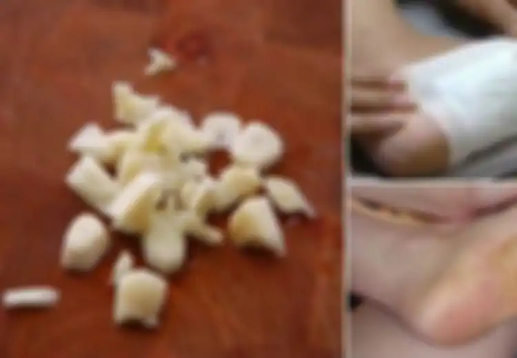 Tempelkan Kain yang Dibasahi Air Bawang di Telapak Kaki Sebelum Tidur, Ini yang Akan Terjadi Pada Tubuh Anda