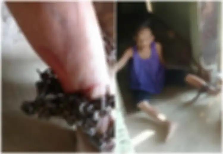 Kejam! Mengidap Alzheimer, Kaki Nenek Ini Dirantai Hingga Berdarah Agar Tidak Bisa Berkeliaran