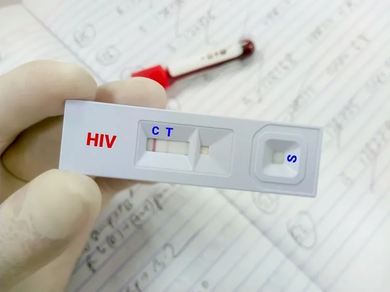 Apakah Tes HIV/AIDS Ditanggung BPJS Kesehatan? Berikut Tahapan Tesnya