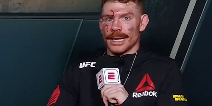 Tiga Hari Setelah Bonyok Dihajar, Paul Felder Langsung Jadi Komentator 