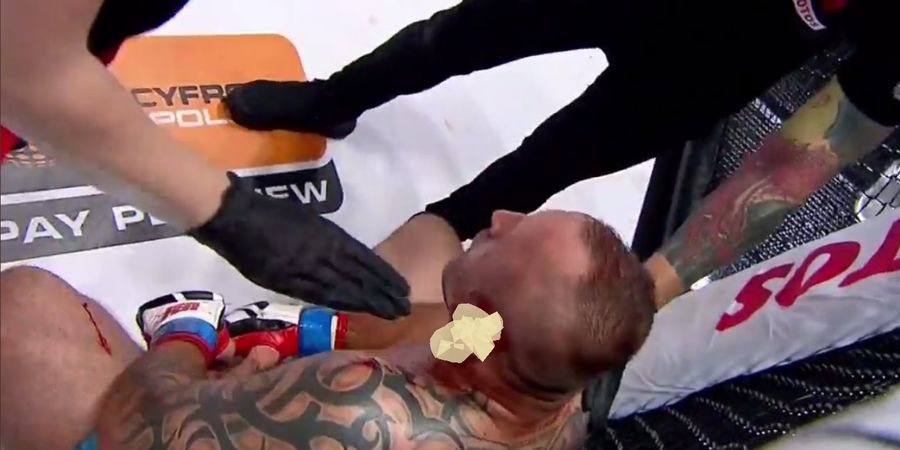 Bintang MMA ini Disikat Lawan Hingga Alami Luka Mengerikan