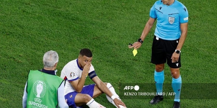 EURO 2024 - Tak Perlu Operasi, Kylian Mbappe Bakal Pakai Topeng Pelindung Usai Patah Hidung