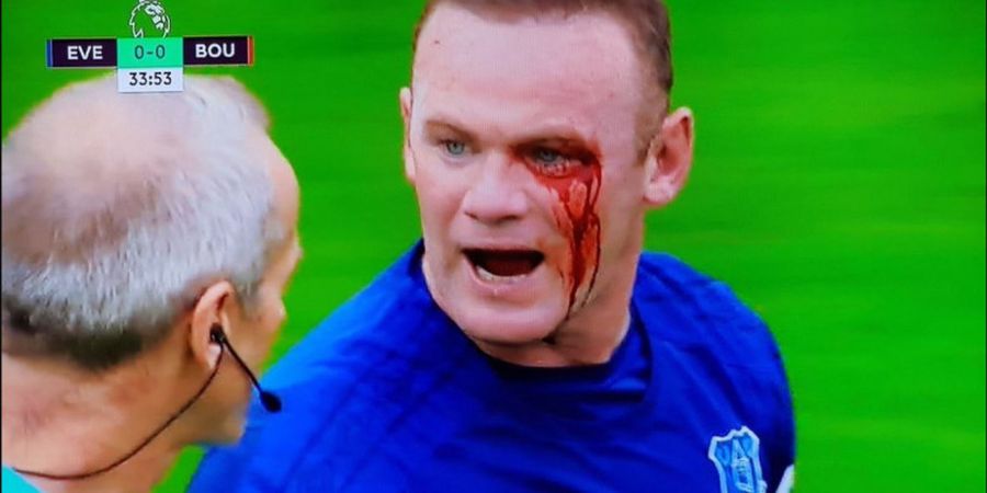VIDEO - Ngeri, Darah Mengalir Deras dari Mata Kanan Wayne Rooney