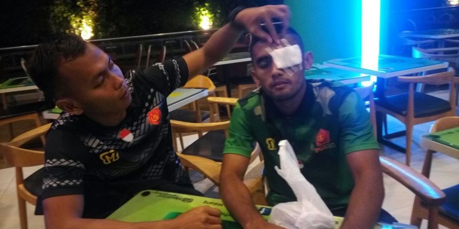 Bek PS TNI Bawa Pulang Cedera dari Laga Kontra Arema FC
