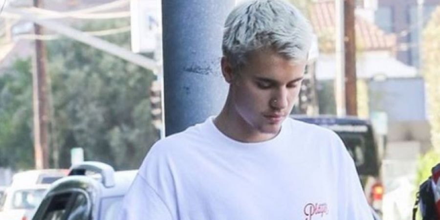 Waduh! Justin Bieber Mengalami Cedera Saat Bermain Sepak Bola