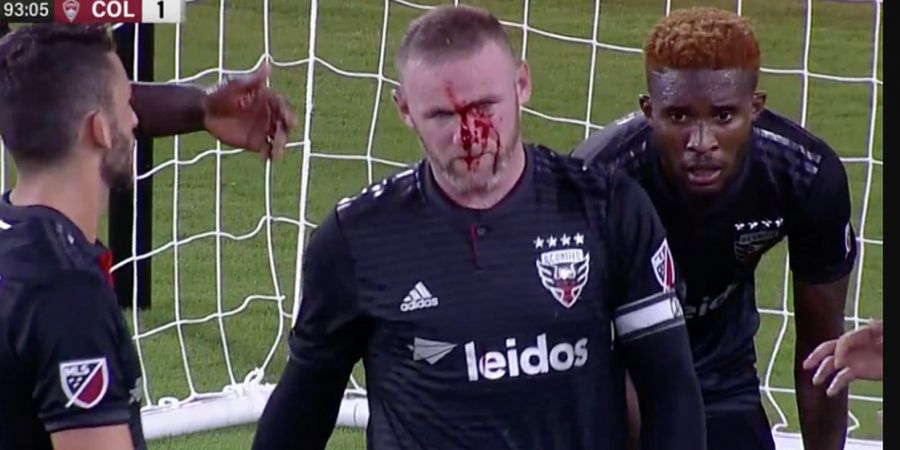 Alami Patah Hidung saat Cetak Gol Perdana, Eks Pemain Manchester United Malah Senang