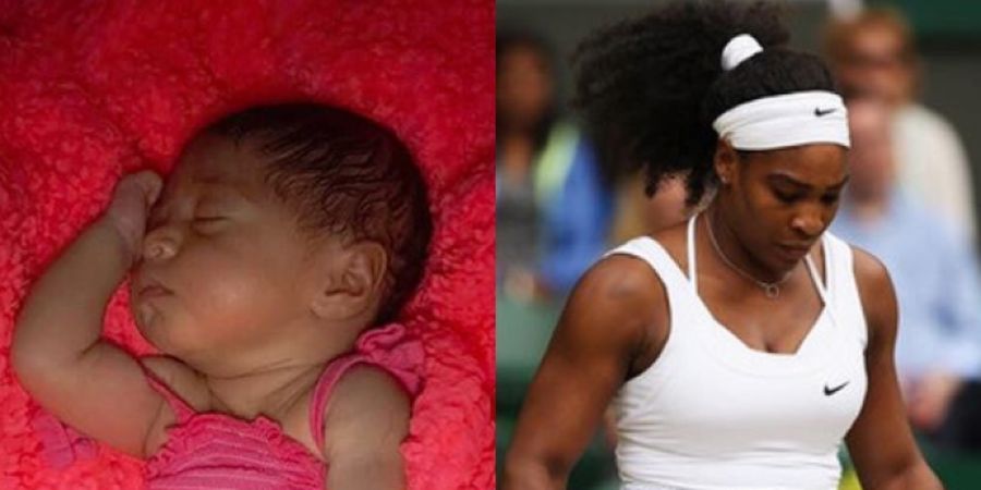 Kocak Abis !  Ekspresi Bayi Serena Williams Ini Bikin Ngakak 