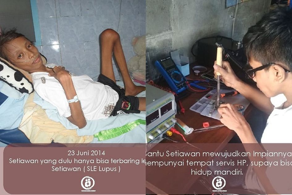 Salut Meskipun Tubuhnya Digerogoti Penyakit Mematikan Namun Semangat Setiawan Untuk Bangkit Tetap Membara