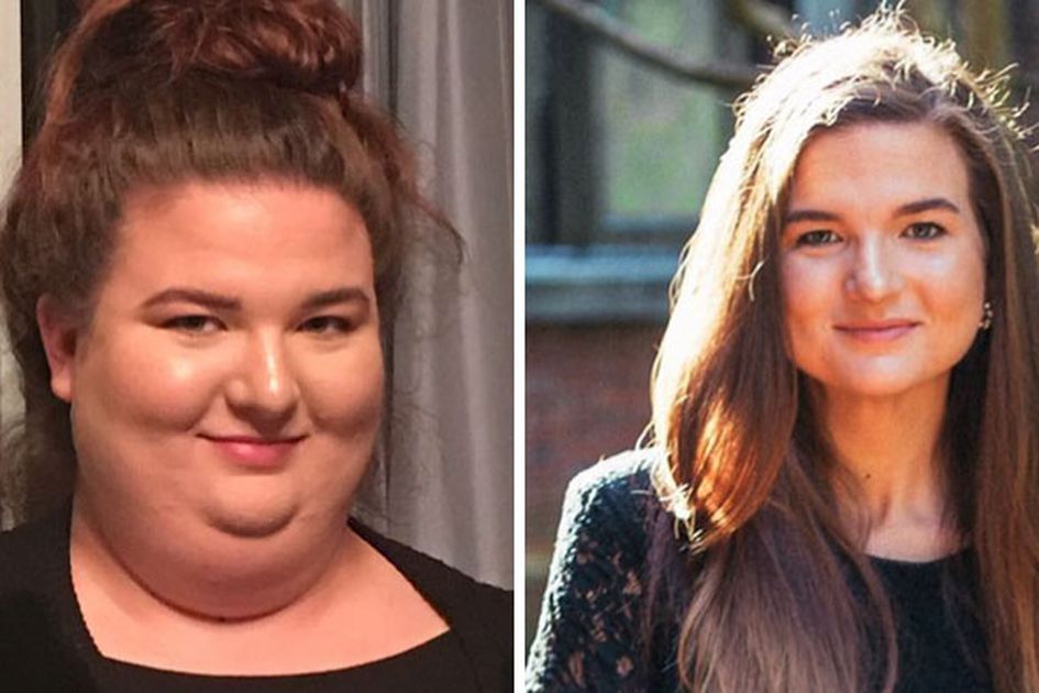 10 Orang Ini Alami Perubahan Drastis Setelah Menurunkan Berat Badan Jadi Kurus Dan Sehat Ternyata Bukan Mimpi