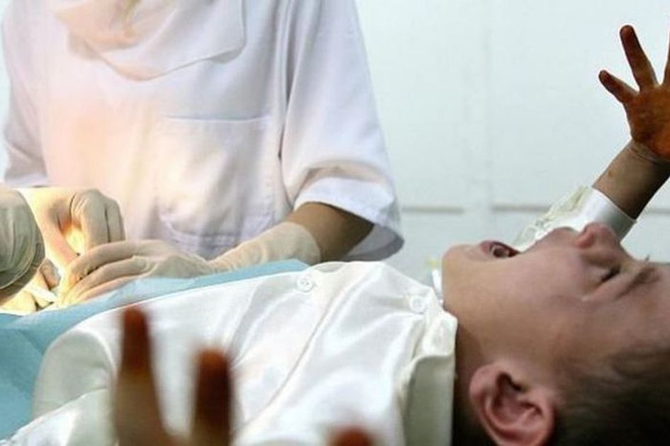 Bocah Malang! Lakukan Sunat Dengan Laser, Alat Kelaminnya Malah Putus