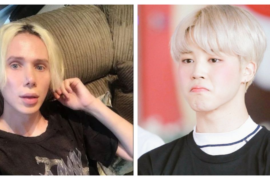 Bts sebelum plastik muka operasi 10 Artis