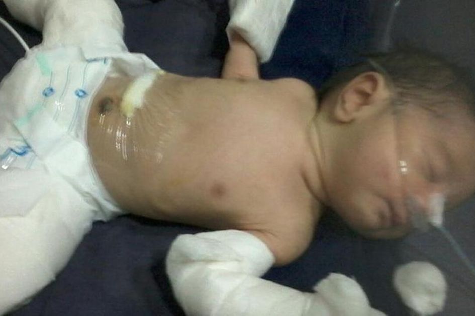 Omg Bayi Laki Laki Baru Lahir Hamil Ada Penyusup Saat Masih Dalam Kandungan