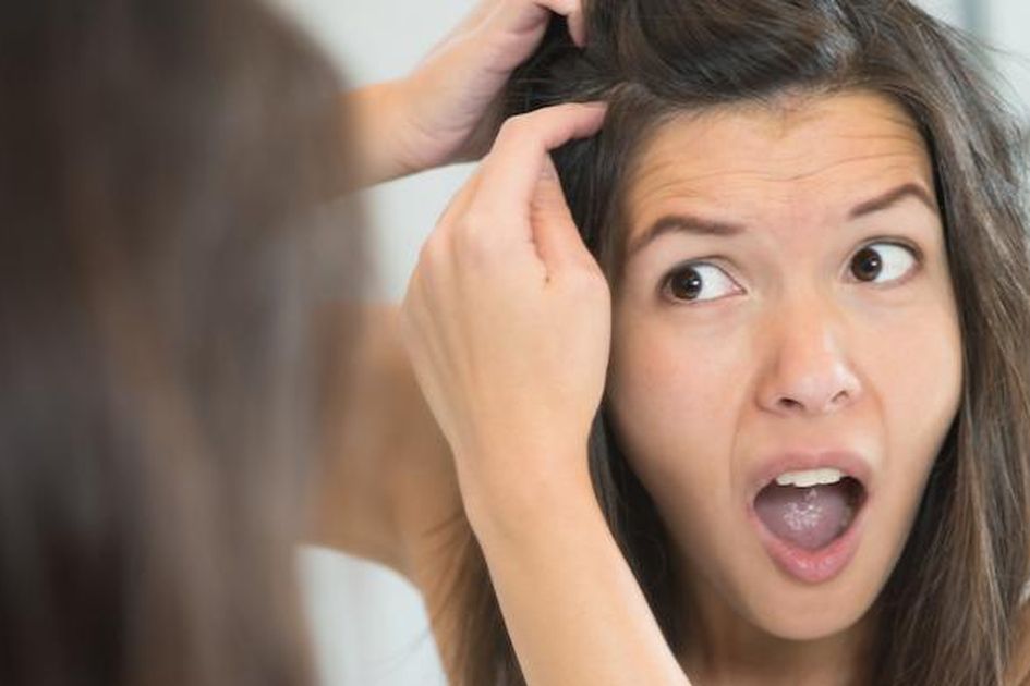 Ketombe Muncul Akibat Malas Keramas Fakta Atau Mitos Ketombe Muncul Akibat Malas Keramas Fakta Atau Mitos