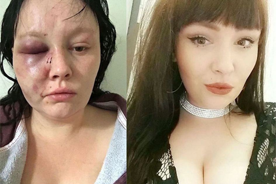 Wanita Cantik Ini Tetap Cinta Kepada Pacarnya Walau Dipukuli Berkali Kali Hingga Hampir Mati Kok Bisa Wanita Cantik Ini Tetap Cinta Kepada Pacarnya Walau Dipukuli Berkali Kali Hingga Hampir Mati Kok Bisa