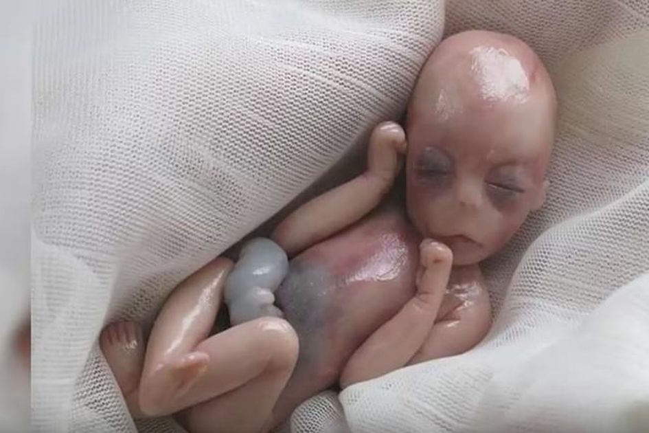 Bayi Ini Dipaksa Lahir Pada Usia 5 Bulan Hingga Akhirnya Mati Namun 8 Menit Kemudian Sungguh Mengharukan Sebuah Keajaiban Terjadi